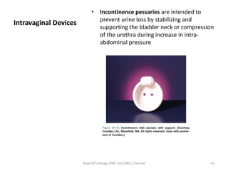 Intravaginal Devices
• Incontinence pessaries are intended to
prevent urine loss by stabilizing and
supporting the bladder neck or compression
of the urethra during increase in intra-
abdominal pressure
Dept Of Urology, KMC and GRH, Chennai 41
 