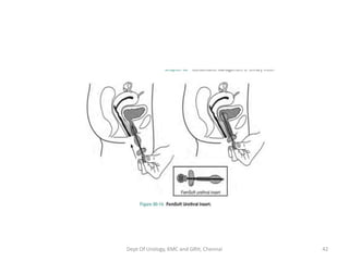 Dept Of Urology, KMC and GRH, Chennai 42
 