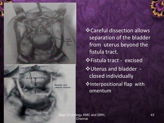 Uro gynacology- vef | PDF