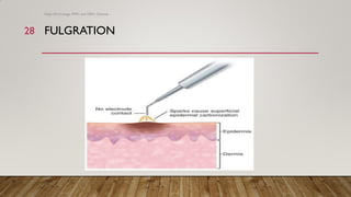 Fulgurated Uro instruments- electrosurgery | PDF