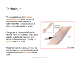 INTRAVENOUS UROGRAPHY | PDF