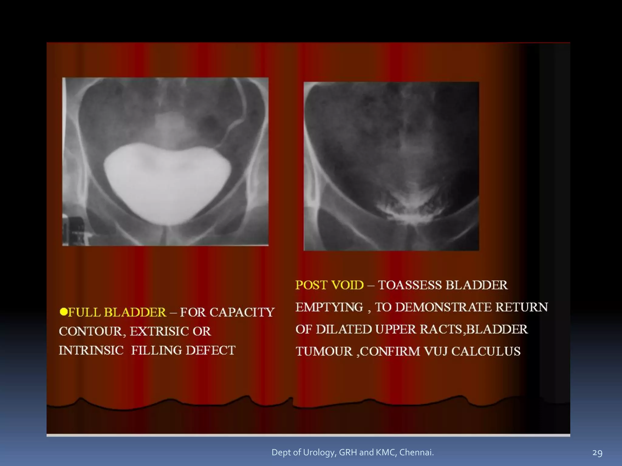 Urography Examples INTRAVENOUS UROGRAPHY 1 | PDF
