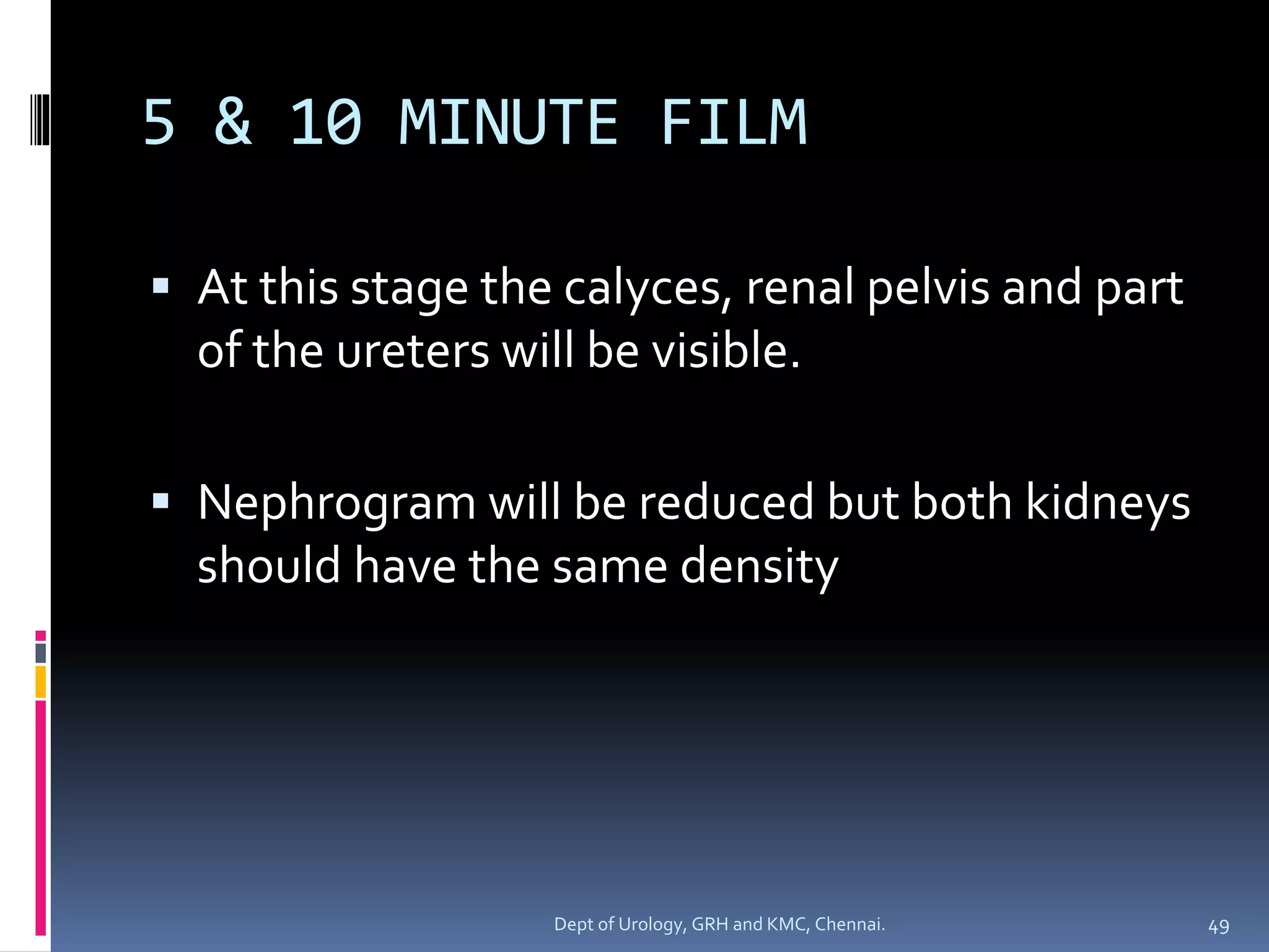 INTRAVENOUS UROGRAPHY 1 | PDF