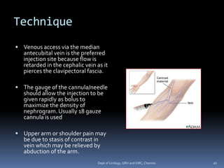 INTRAVENOUS UROGRAPHY 1 | PDF