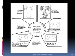 26
Dept of Urology, GRH and KMC, Chennai.
 