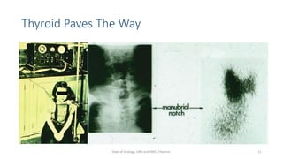 Thyroid Paves The Way
11
Dept of Urology, GRH and KMC, Chennai.
 