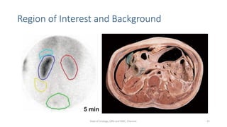 Region of Interest and Background
21
Dept of Urology, GRH and KMC, Chennai.
 