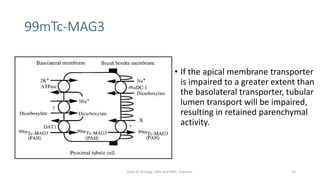 99mTc-MAG3
• If the apical membrane transporter
is impaired to a greater extent than
the basolateral transporter, tubular
lumen transport will be impaired,
resulting in retained parenchymal
activity.
35
Dept of Urology, GRH and KMC, Chennai.
 