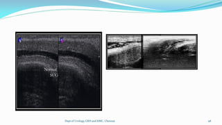 ULTRASOUND IN UROLOGY | PDF