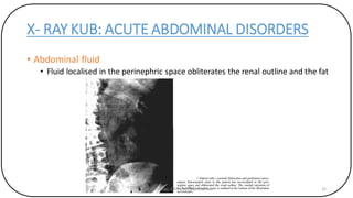 X RAY KUB 2 | PDF