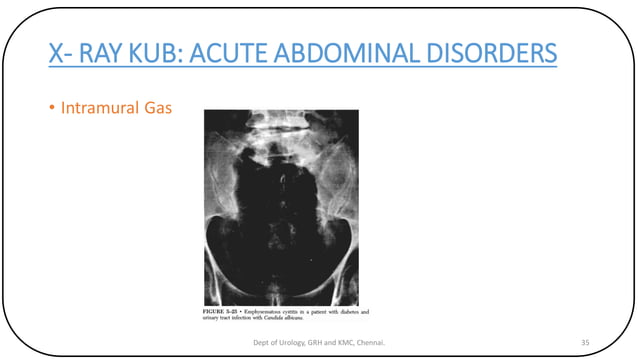 X RAY KUB 2 | PDF