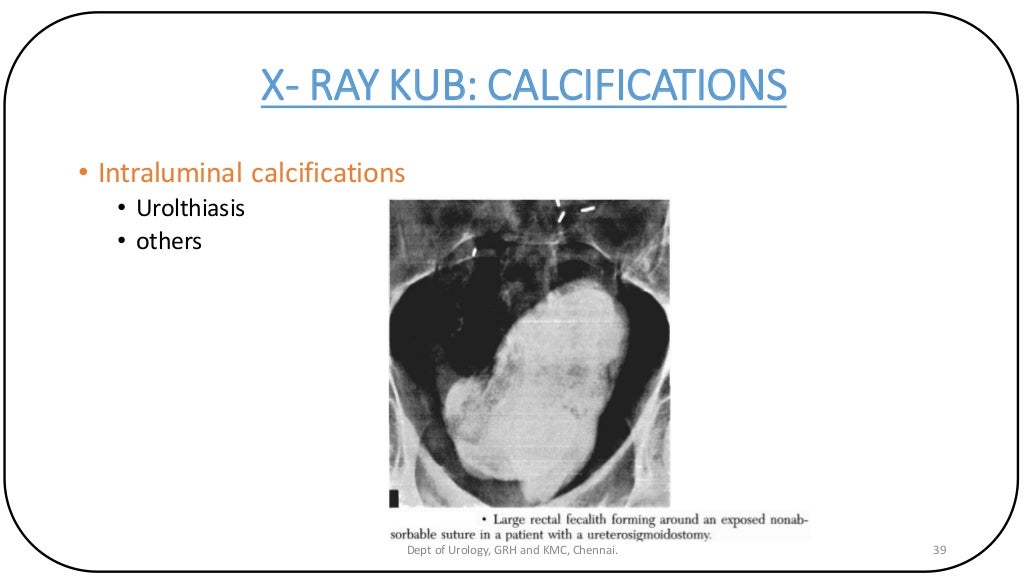 X RAY KUB 2