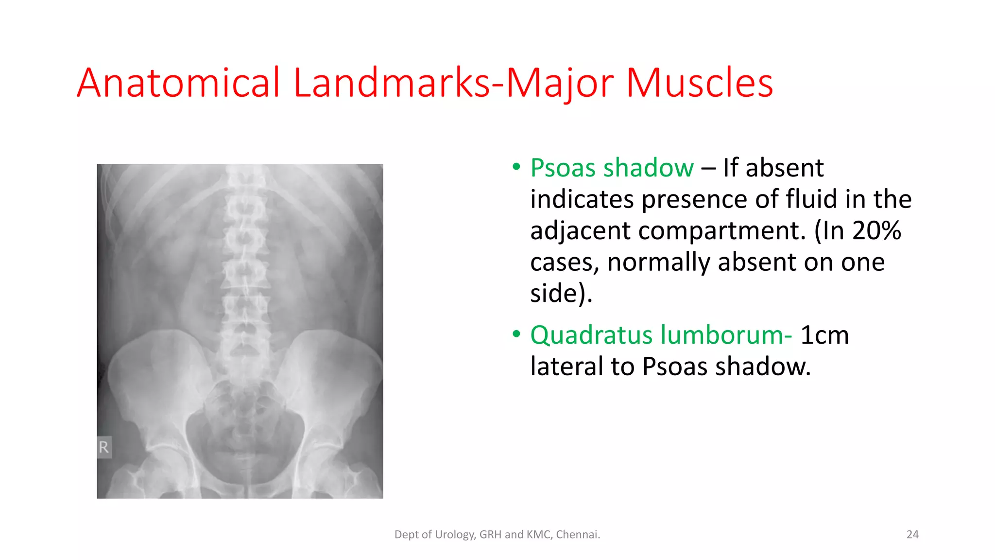 X RAY KUB 1 | PDF