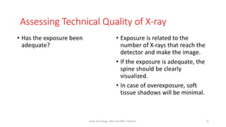 • Has the exposure been
adequate?
• Exposure is related to the
number of X‐rays that reach the
detector and make the image.
• If the exposure is adequate, the
spine should be clearly
visualized.
• In case of overexposure, soft
tissue shadows will be minimal.
Assessing Technical Quality of X-ray
12
Dept of Urology, GRH and KMC, Chennai.
 