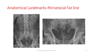Anatomical Landmarks-Perivesical Fat line
26
Dept of Urology, GRH and KMC, Chennai.
 