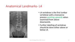 Anatomical Landmarks- L4
• L4 vertebrae is the first lumbar
vertebrae with a transverse
process pointing upwards when
examined from above
downwards.
• Further labelling of vertebrae
should be done either above or
below L4.
27
Dept of Urology, GRH and KMC, Chennai.
 