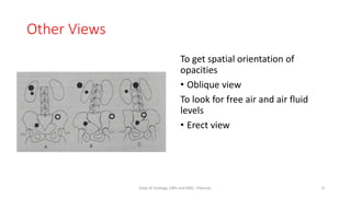 Other Views
To get spatial orientation of
opacities
• Oblique view
To look for free air and air fluid
levels
• Erect view
9
Dept of Urology, GRH and KMC, Chennai.
 