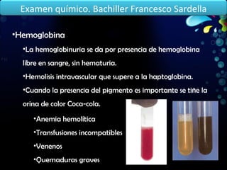 Hemoglobina La hemoglobinuria se da por presencia de hemoglobina libre en sangre, sin hematuria. Hemolisis intravascular que supere a la haptoglobina. Cuando la presencia del pigmento es importante se tiñe la orina de color Coca-cola. Anemia hemolítica Transfusiones incompatibles Venenos Quemaduras graves Examen químico. Bachiller Francesco Sardella 