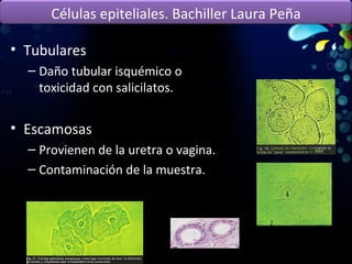 Tubulares Daño tubular isquémico o toxicidad con salicilatos. Escamosas Provienen de la uretra o vagina. Contaminación de la muestra. Células epiteliales. Bachiller Laura Peña 