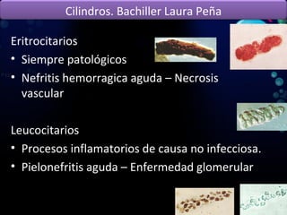 Eritrocitarios Siempre patológicos Nefritis hemorragica aguda – Necrosis vascular Leucocitarios Procesos inflamatorios de causa no infecciosa. Pielonefritis aguda – Enfermedad glomerular  Cilindros. Bachiller Laura Peña 