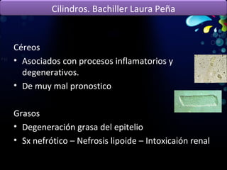 Céreos Asociados con procesos inflamatorios y degenerativos. De muy mal pronostico Grasos Degeneración grasa del epitelio Sx nefrótico – Nefrosis lipoide – Intoxicaión renal Cilindros. Bachiller Laura Peña 
