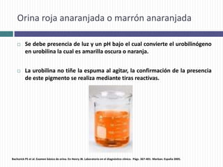 Orina roja anaranjada o marrón anaranjada
 Se debe presencia de luz y un pH bajo el cual convierte el urobilinógeno
en urobilina la cual es amarilla oscura o naranja.
 La urobilina no tiñe la espuma al agitar, la confirmación de la presencia
de este pigmento se realiza mediante tiras reactivas.
Bachorick PS et al. Examen básico de orina. En Henry JB. Laboratorio en el diagnóstico clínico. Págs. 367-401. Marban. España 2005.
 
