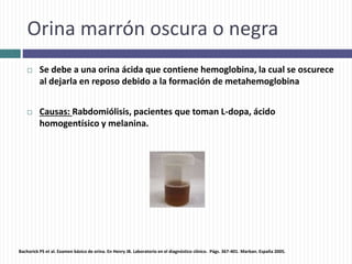 Orina marrón oscura o negra
 Se debe a una orina ácida que contiene hemoglobina, la cual se oscurece
al dejarla en reposo debido a la formación de metahemoglobina
 Causas: Rabdomiólisis, pacientes que toman L-dopa, ácido
homogentísico y melanina.
Bachorick PS et al. Examen básico de orina. En Henry JB. Laboratorio en el diagnóstico clínico. Págs. 367-401. Marban. España 2005.
 