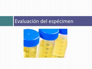 Evaluación del espécimen
 
