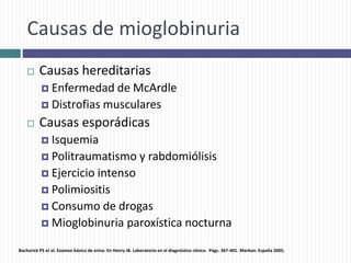 Causas de mioglobinuria
 Causas hereditarias
 Enfermedad de McArdle
 Distrofias musculares
 Causas esporádicas
 Isquemia
 Politraumatismo y rabdomiólisis
 Ejercicio intenso
 Polimiositis
 Consumo de drogas
 Mioglobinuria paroxística nocturna
Bachorick PS et al. Examen básico de orina. En Henry JB. Laboratorio en el diagnóstico clínico. Págs. 367-401. Marban. España 2005.
 