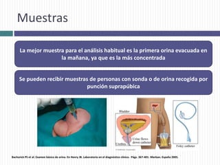 Muestras
La mejor muestra para el análisis habitual es la primera orina evacuada en
la mañana, ya que es la más concentrada
Se pueden recibir muestras de personas con sonda o de orina recogida por
punción suprapúbica
Bachorick PS et al. Examen básico de orina. En Henry JB. Laboratorio en el diagnóstico clínico. Págs. 367-401. Marban. España 2005.
 