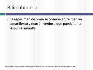 Bilirrubinuria
 El espécimen de orina se observa entre marrón
amarillento y marrón verdoso que puede tener
espuma amarilla
Bachorick PS et al. Examen básico de orina. En Henry JB. Laboratorio en el diagnóstico clínico. Págs. 367-401. Marban. España 2005.
 