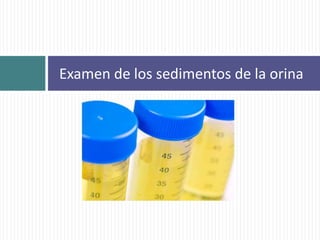 Examen de los sedimentos de la orina
 
