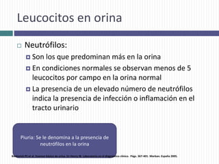 Leucocitos en orina
 Neutrófilos:
 Son los que predominan más en la orina
 En condiciones normales se observan menos de 5
leucocitos por campo en la orina normal
 La presencia de un elevado número de neutrófilos
indica la presencia de infección o inflamación en el
tracto urinario
Piuria: Se le denomina a la presencia de
neutrófilos en la orina
Bachorick PS et al. Examen básico de orina. En Henry JB. Laboratorio en el diagnóstico clínico. Págs. 367-401. Marban. España 2005.
 
