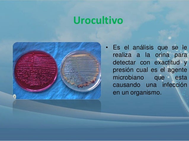Urocultivo