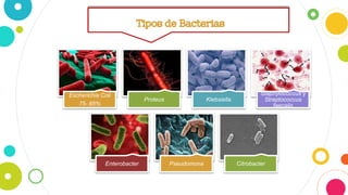 Escherichia Coli
75- 85%
Proteus Klebsiella
Staphylococcus y
Streptococcus
faecalis
Enterobacter Pseudomona Citrobacter
 