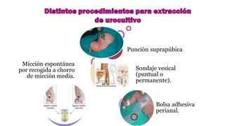Micción espontánea
por recogida a chorro
de micción media.
Bolsa adhesiva
perianal.
Sondaje vesical
(puntual o
permanente).
Punción suprapúbica
 