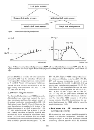 Leak point pressure

Detrusor leak point pressure

Abdominal leak point pressure

Valsalva leak point pressure

Cough leak point pressure

Figure 7 : Nomenclature for leak point pressures

cm H2O

cm H2O

Stop filling

P

P

VLPP

DLPP

a

b

Volume (ml)

Volume (ml)

Figure 8 : Measurement of detrusor leak point pressure (DLPP: left) and Valsalva leak point pressure (VLPP: right). The rise
in pressure from the base line (a) or from the zero level (b) represents VLPP depending on the investigators. Arrows indicate leakage.

pressure (DLPP) is to assess the risk to the upper urina168 182 183
ry tract [168, 182, 183]. The critical cut-off value between high and low leak point pressure is approximately 40 cm H2O. Patients with neurogenic bladder dys-

185, 188, 189, 202]. Low ALPP is likely to be associa185 188 189 202
ted with increased leakage on pad tests 191 197, 208
[191, 197 208,
209] and increased symptomatic severity of stress
209
46 48, 167 168, 184 202 210 211],
incontinence [46, 48 167, 168 184, 202, 210, 211 but
some reports contradict this association [59, 63 212
59 63, 212,
213]. There is a low concordance between low maxi213
15
mum urethral (closure) pressure and low ALPP [15,
167 176 178 180 181 193 48 168 183 185 197,
167, 176, 178, 180, 181, 193] [48, 168, 183, 185, 197
211, 214-216].
211 214 - 216 Thus, the gold standard method for the
diagnosis of intrinsic sphincter deficiency is controversial. The value of the ALPP is related to pelvic floor
48 208
muscle properties [48, 208]. A recent report has suggested that iatrogenic low ALPP might be caused by
simple hysterectomy [217].
217

function and a DLPP above this level are at risk for
102 168, 172, 173
upper urinary tract deterioration [102, 168 172 173,
183, 199] [177, 204 - 207
183 199 177 204-207].

b) Abdominal leak point pressure
The abdominal leak point pressure (ALPP) assesses the
abdominal pressure (or pressure increase) that causes
stress incontinence and thus offers a direct measure of
168 182 183
the urethral contribution to continence [168, 182, 183].
High values (greater than 90-100 cm H2O) suggest that
stress incontinence is associated with descent of the
168
bladder base descent or so called ÒhypermobilityÓ [168,
185, 188],
185 188 reflecting pelvic floor weakness. A co-existing cystocele may cause artifactually high leak point
pressures and should probably be repositioned during
the test [193]. Low values, less than about 60 cm H2O,
193
reflect more severe stress incontinence and suggest that
168 178 183,
there is intrinsic sphincter deficiency [168, 178, 183

4. INDICATION

FOR

LPP

MEASUREMENT IN

INCONTINENT PATIENTS

The detrusor leak point pressure should be assessed in
patients with overflow incontinence, particularly of
neurogenic origin. In those with neurogenic detrusor
overactivity detrusor pressure should be monitored

339

 