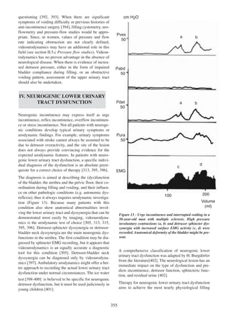 392 393
questioning [392, 393]. When there are significant
symptoms of voiding difficulty or previous histories of
394
anti-incontinence surgery [394], filling cystometry, uroflowmetry and pressure-flow studies would be appropriate. Since, in women, values of pressure and flow
rate indicating obstruction are not clearly defined,
videourodynamics may have an additional role in this
field (see section II.5.c Pressure flow studies). Videourodynamics has no proven advantage in the absence of
neurological disease. When there is evidence of increased detrusor pressure, either in the form of impaired
bladder compliance during filling, or an obstructive
voiding pattern, assessment of the upper urinary tract
should also be undertaken.

IV. NEUROGENIC LOWER URINARY
TRACT DYSFUNCTION
Neurogenic incontinence may express itself as urge
incontinence, reflex incontinence, overflow incontinence or stress incontinence. Not all patients with neurogenic conditions develop typical urinary symptoms or
urodynamic findings. For example, urinary symptoms
associated with stroke cannot always be assumed to be
due to detrusor overactivity, and the site of the lesion
does not always provide convincing evidence for the
expected urodynamic features. In patients with neurogenic lower urinary tract dysfunction, a specific individual diagnosis of the dysfunction is an absolute prere313 395 396
quisite for a correct choice of therapy [313, 395, 396].

cm H2O

Pves
50

a

b

a

b

Pabd
50

Pdet
50

Pura
50

c

d

EMG

The diagnosis is aimed at describing the (dys)function
of the bladder, the urethra and the pelvic floor, their coordination during filling and voiding, and their influence on other pathologic conditions (e.g. autonomic dysreflexia); thus it always requires urodynamic investigation (Figure 13). Because many patients with this
condition also show anatomical abnormalities involving the lower urinary tract and dyssynergia that can be
demonstrated most easily by imaging, videourodynamics is the urodynamic test of choice [305, 313, 315,
305 313 315
395, 396]. Detrusor-sphincter dyssynergia or detrusor395 396
bladder neck dyssynergia are the main neurogenic dysfunctions in the urethra. The first condition may be diagnosed by sphincter EMG recording, but it appears that
videourodynamics is an equally accurate a diagnostic
305
tool for this condition [305]. Detrusor-bladder neck
dyssynergia can be diagnosed only by videourodyna397
mics [397]. Ambulatory urodynamics might offer a better approach to recording the actual lower urinary tract
dysfunction under normal circumstances. The ice water

100

200
Volume
(ml)

Figure 13 : Urge incontinence and interrupted voiding in a
50-year-old man with multiple sclerosis. High pressure
involuntary contractions (a, b) and detrusor sphincter dyssynergia with increased surface EMG activity (c, d) were
recorded. Anatomical deformity of the bladder might be present.

A comprehensive classification of neurogenic lower
urinary tract dysfunction was adapted by H. Burgdšrfer
from the literature[402]. The neurological lesion has an
402
immediate impact on the type of dysfunction and predicts incontinence, detrusor function, sphincteric func402
tion, and residual urine [402].

398 - 400
test [398-400] is believed to be specific for neurogenic
detrusor dysfunction, but it must be used judiciously in
401
young children [401].

Therapy for neurogenic lower urinary tract dysfunction
aims to achieve the most nearly physiological filling

355

 