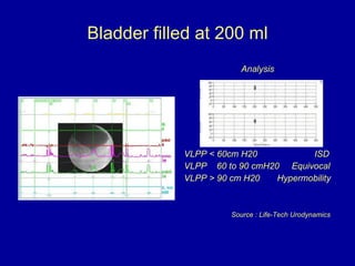 Bladder filled at 200 ml <ul><li>Analysis </li></ul><ul><li>VLPP < 60cm H20  ISD </li></ul><ul><li>VLPP  60 to 90 cmH20  E...