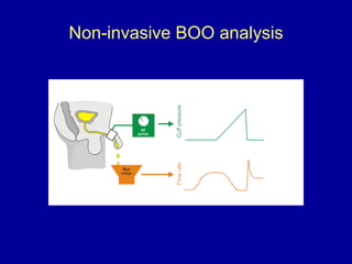 Non-invasive BOO analysis 