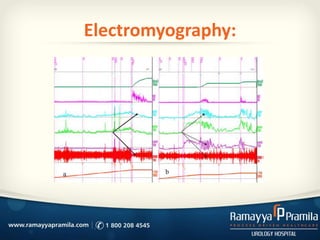 Electromyography:
 