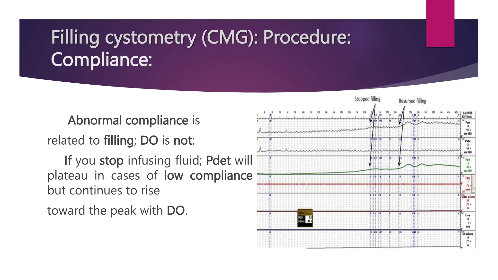 Filling cystometry (CMG): Procedure:
Compliance:
Abnormal compliance is
related to filling; DO is not:
If you stop infusing fluid; Pdet will
plateau in cases of low compliance
but continues to rise
toward the peak with DO.
 