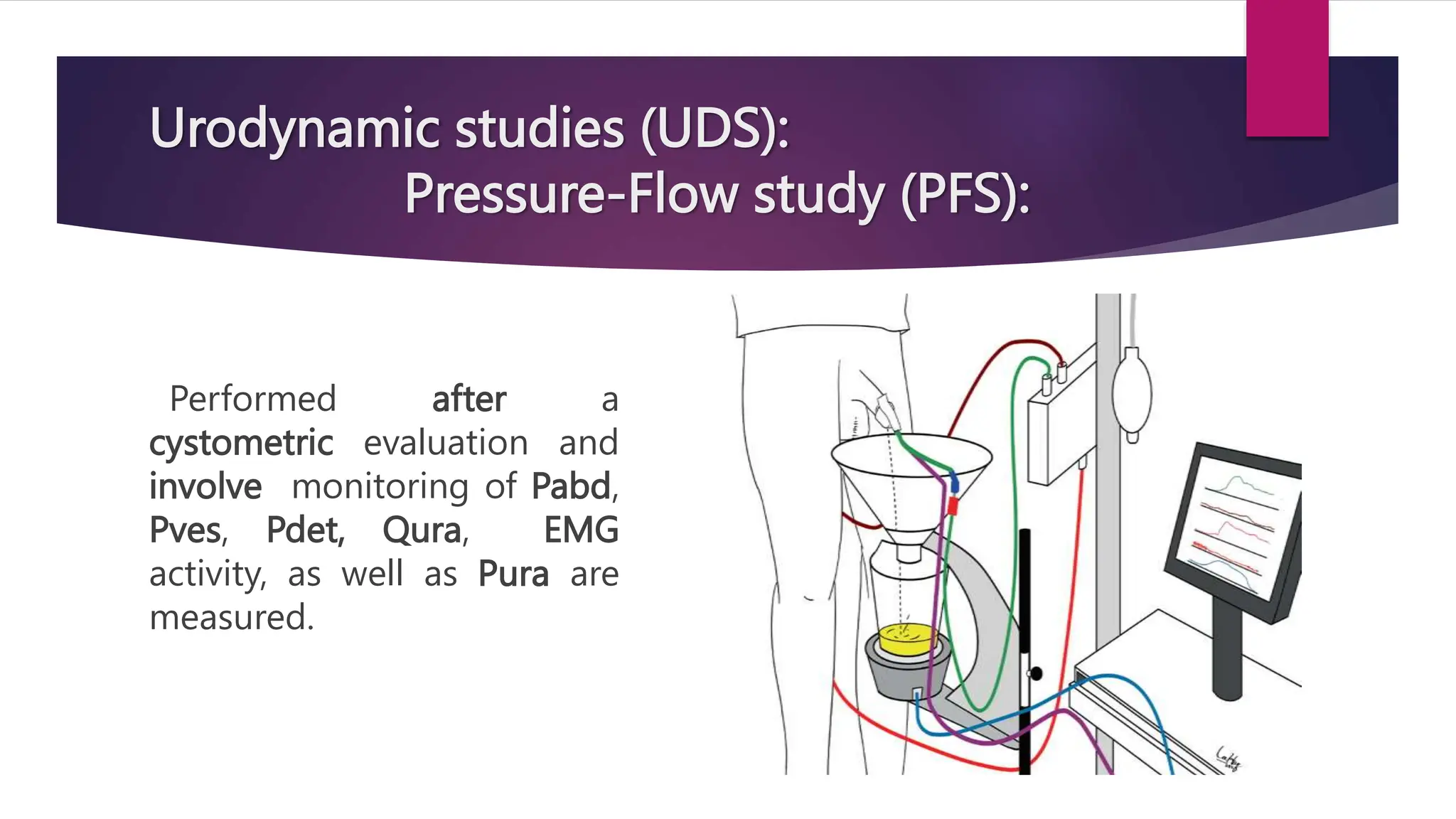 Urodynamic studies (UDS):
Pressure-Flow study (PFS):
Performed after a
cystometric evaluation and
involve monitoring of Pabd,
Pves, Pdet, Qura, EMG
activity, as well as Pura are
measured.
 