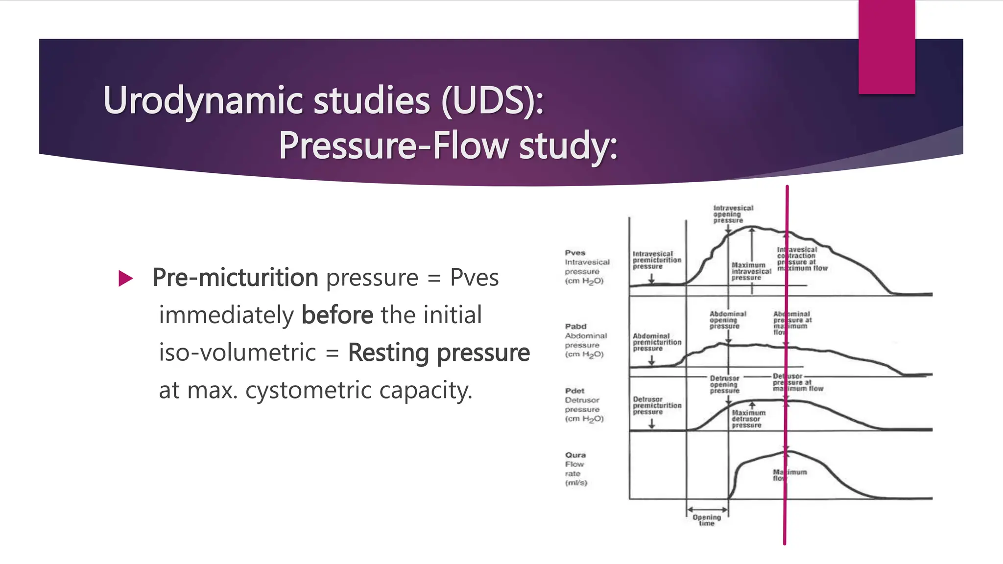 Urodynamic studies (UDS):
Pressure-Flow study:
 Pre-micturition pressure = Pves
immediately before the initial
iso-volumetric = Resting pressure
at max. cystometric capacity.
 