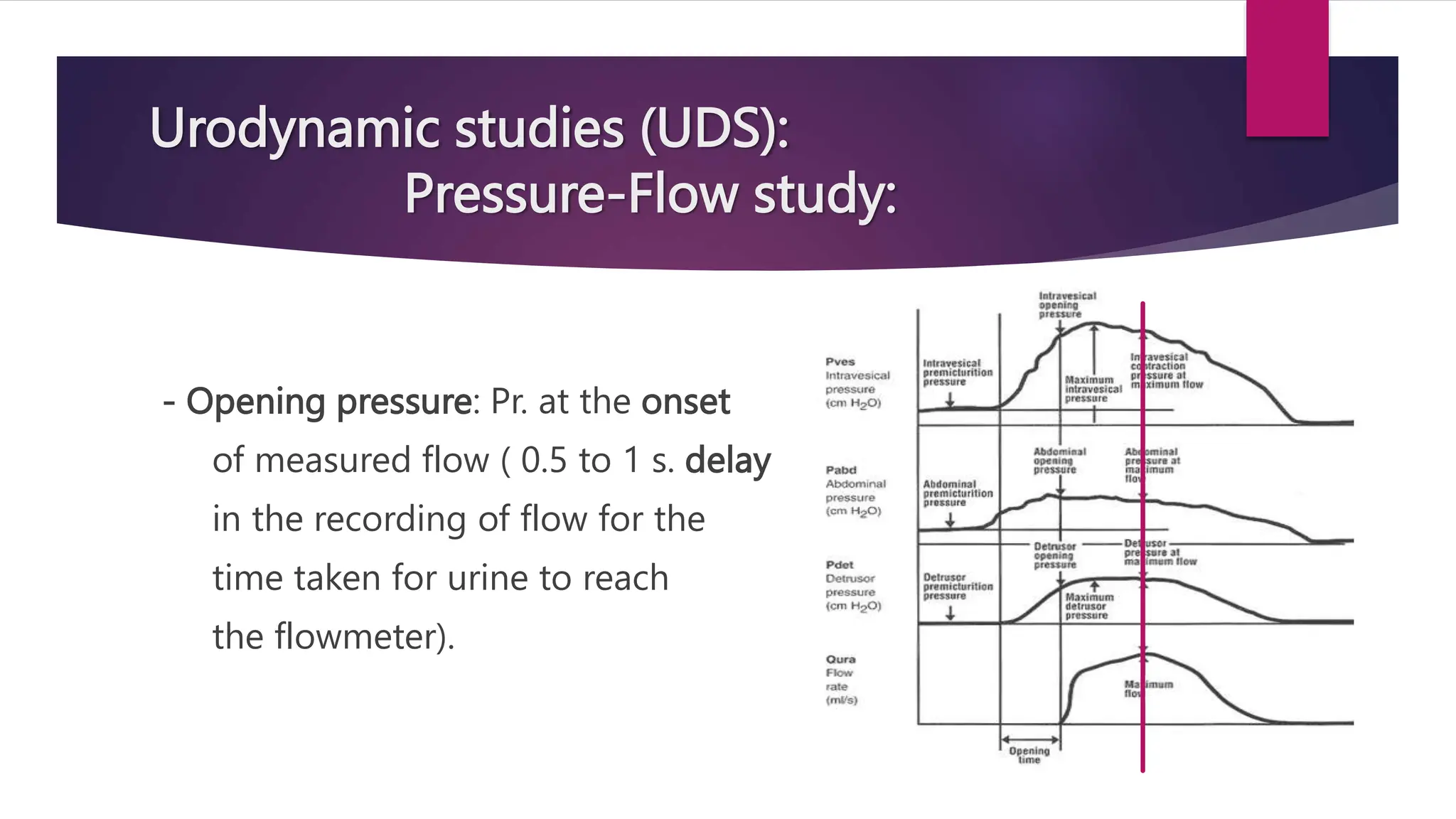 Urodynamic studies (UDS):
Pressure-Flow study:
- Opening pressure: Pr. at the onset
of measured flow ( 0.5 to 1 s. delay
in the recording of flow for the
time taken for urine to reach
the flowmeter).
 