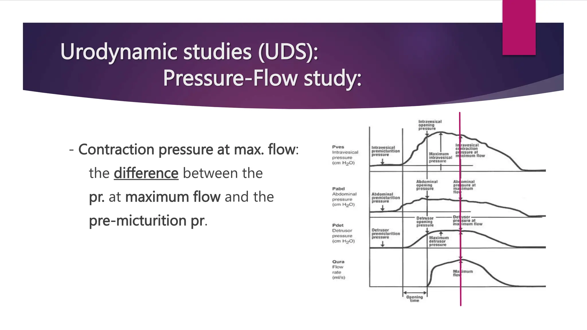 Urodynamic studies (UDS):
Pressure-Flow study:
- Contraction pressure at max. flow:
the difference between the
pr. at maximum flow and the
pre-micturition pr.
 