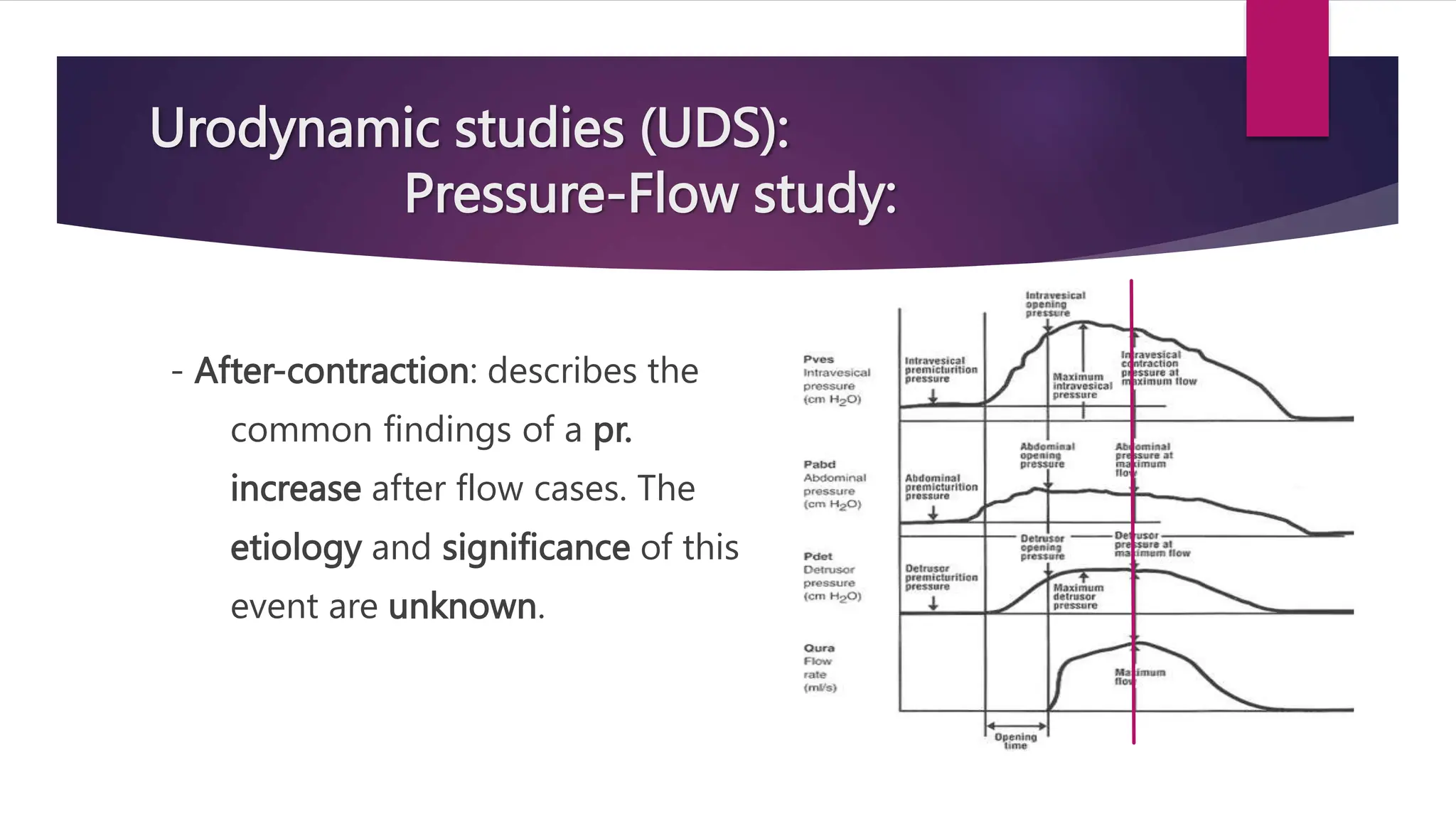 Urodynamic studies (UDS):
Pressure-Flow study:
- After-contraction: describes the
common findings of a pr.
increase after flow cases. The
etiology and significance of this
event are unknown.
 