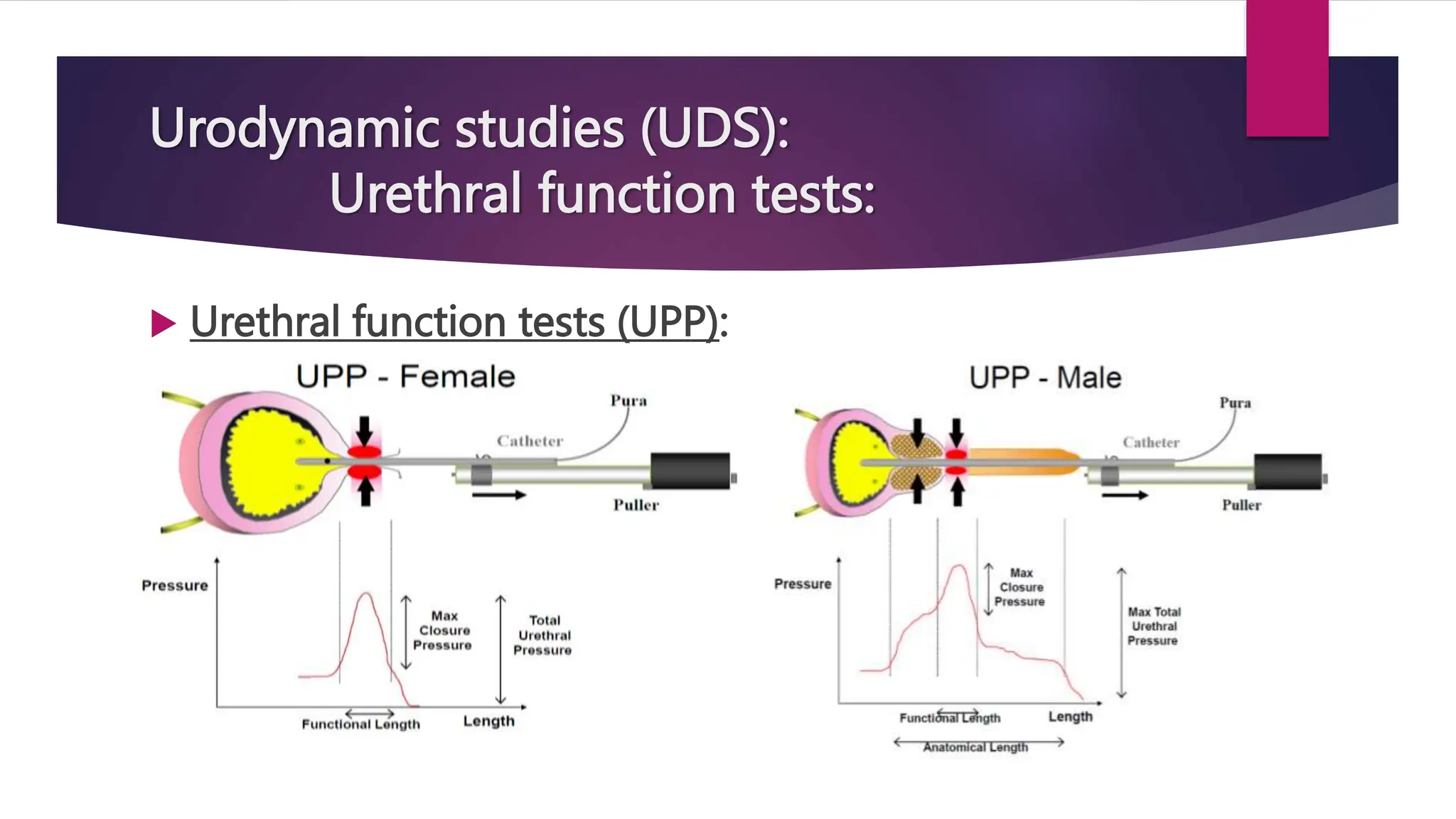 Urodynamic studies (UDS):
Urethral function tests:
 Urethral function tests (UPP):
Female Male
 