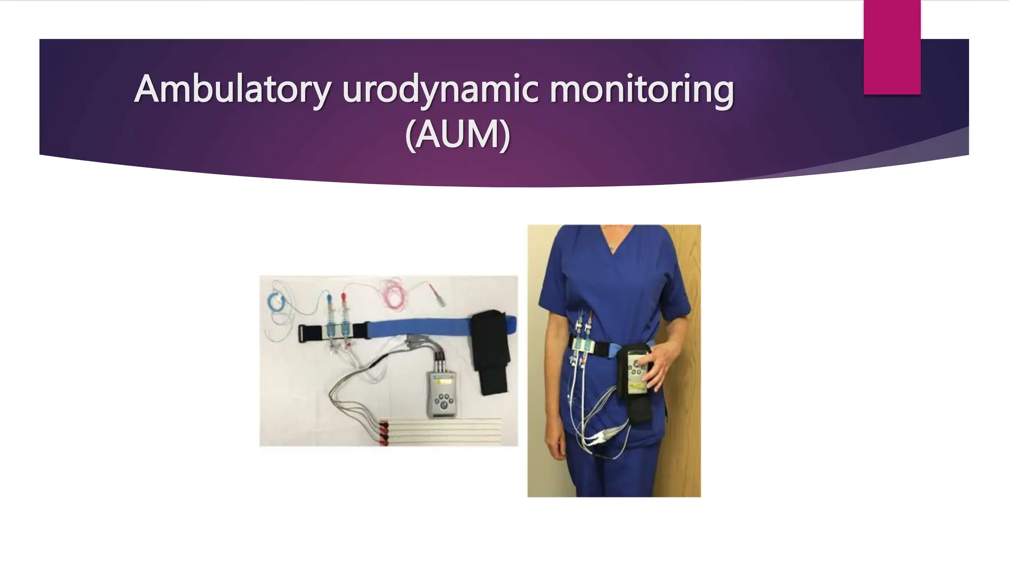 Ambulatory urodynamic monitoring
(AUM)
 