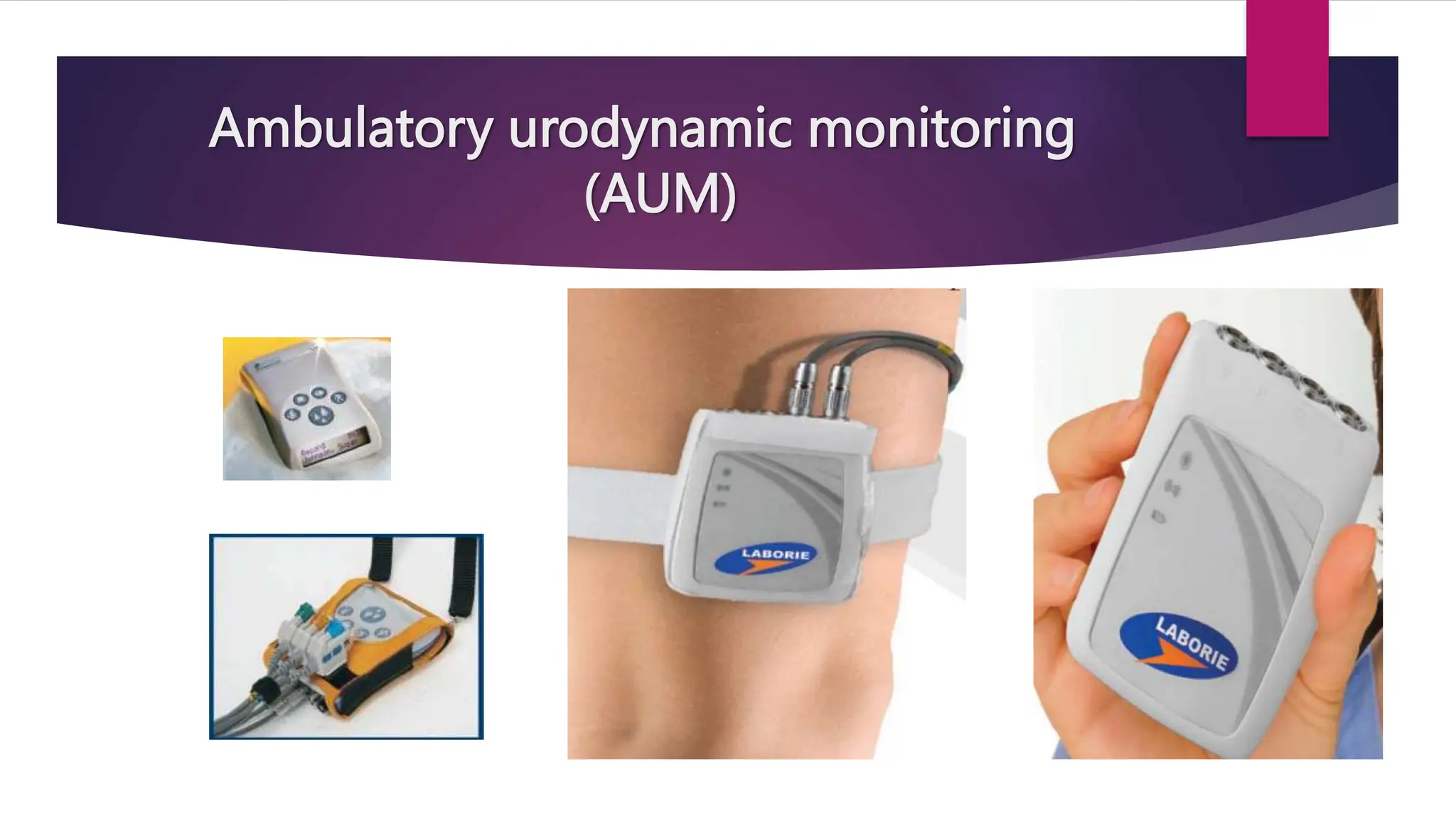Ambulatory urodynamic monitoring
(AUM)
 